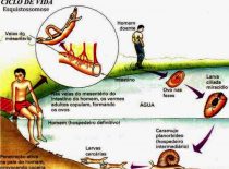 Helmintíase – Esquistossomíase Mansônica